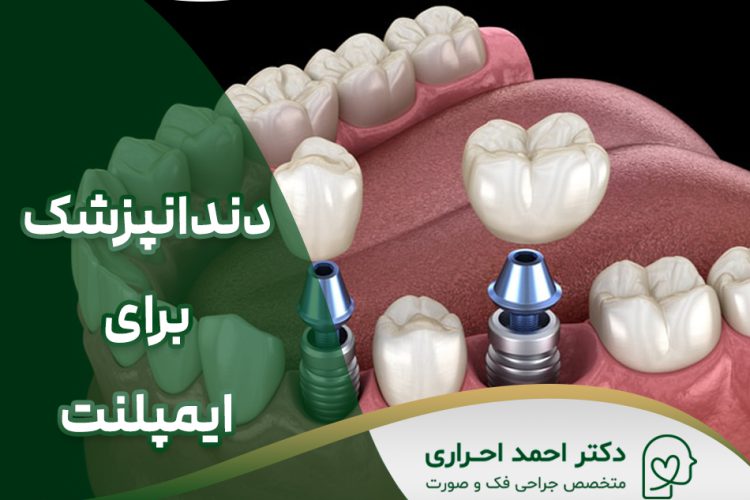 انتخاب دندانپزشک برای کاشت ایمپلنت دندان در تهران