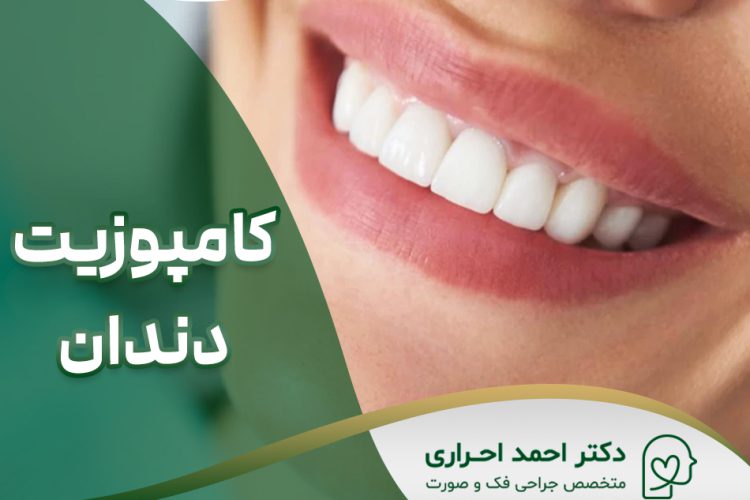 کامپوزیت دندان در تهران